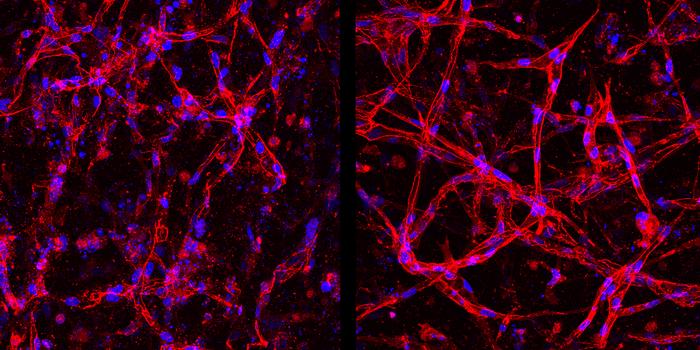 Healthy (right) and deteriorated (left) human retinal endothelial cells.