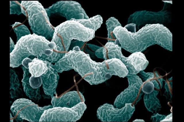 Scanning electron micrograph of Campylobacter jejuni.