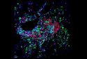Image shows dendritic cells (green) acting as organizers within a cancer-fighting immune hub called a tertiary lymphoid structure.