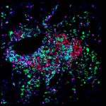 Image shows dendritic cells (green) acting as organizers within a cancer-fighting immune hub called a tertiary lymphoid structure.