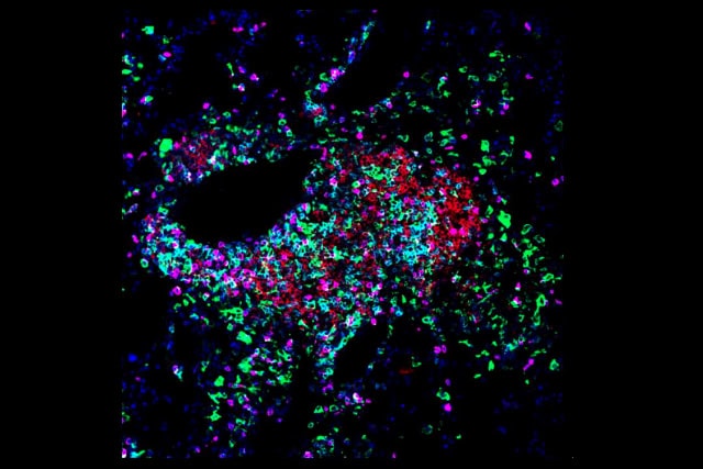 Image shows dendritic cells (green) acting as organizers within a cancer-fighting immune hub called a tertiary lymphoid structure.