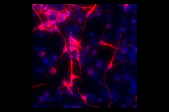 Representative immunofluorescence image of Tuj1-positive neurons differentiated from rat hippocampal neural stem cells.