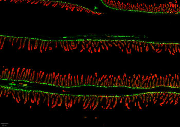 Mouse intestinal lining.