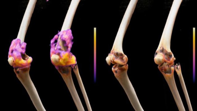 Knee joints of a study participant before and after treatment.