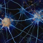 Toxic tau protein accumulation in neurons is associated with neurodegenerative diseases (illustration).
