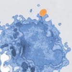 Pseudocolored electron microscope image.