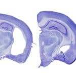 Tauopathy mouse brains/