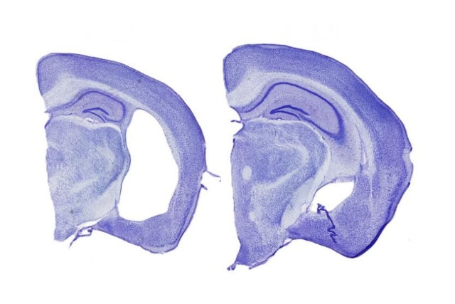 Tauopathy mouse brains/