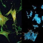 Cancer-associated fibroblasts.
