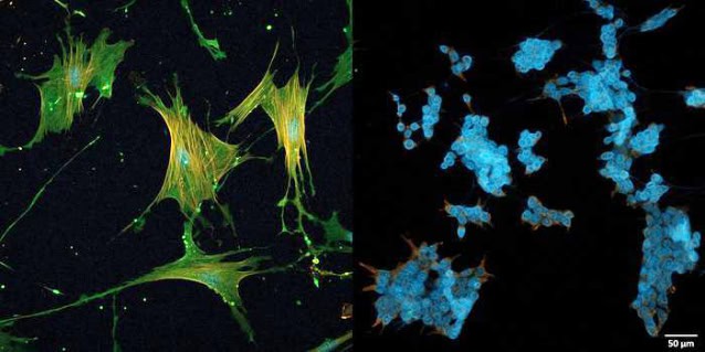 Cancer-associated fibroblasts.