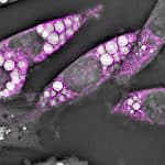 Brown fat cells.