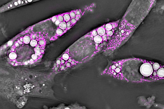 Brown fat cells.