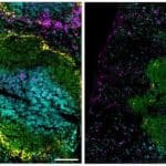 Effect vaccination on mouse spleen (IMAGE)