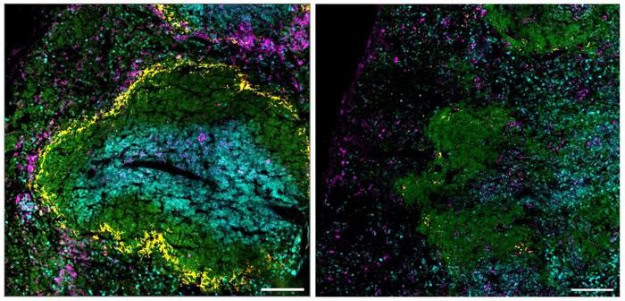 Effect vaccination on mouse spleen (IMAGE)